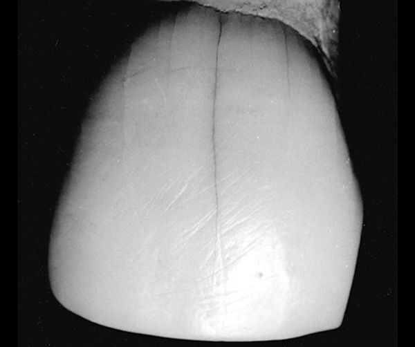 Las tres manos del linaje neandertal