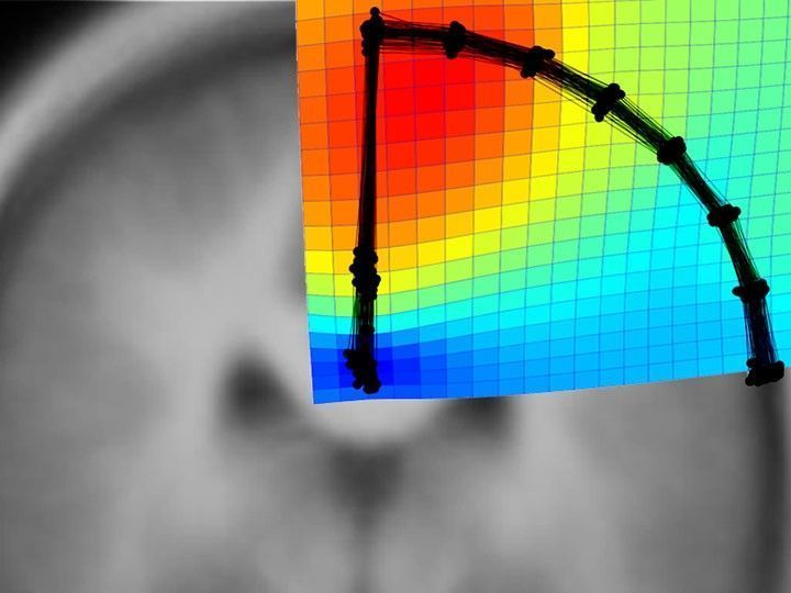 El CENIEH avanza en la investigación sobre el gran desconocido, el cerebro humano