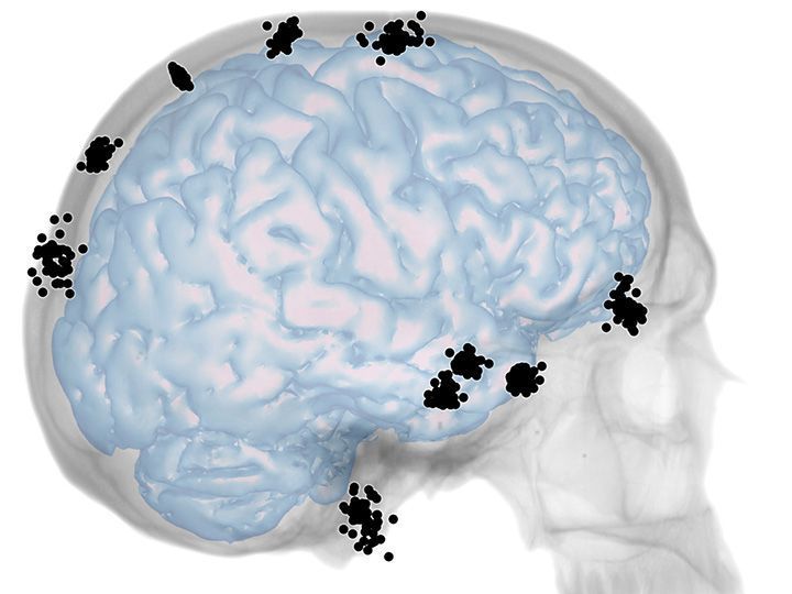 El CENIEH publica nuevo estudio sobre la integración entre cráneo y cerebro