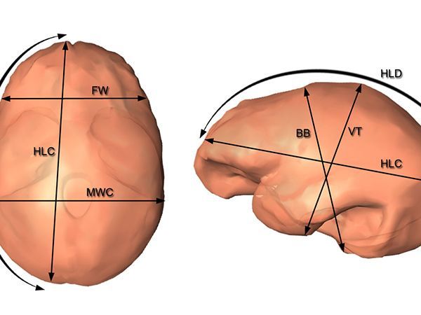 El tamaño cerebral diferencia las variedades asiática y africana del Homo erectus