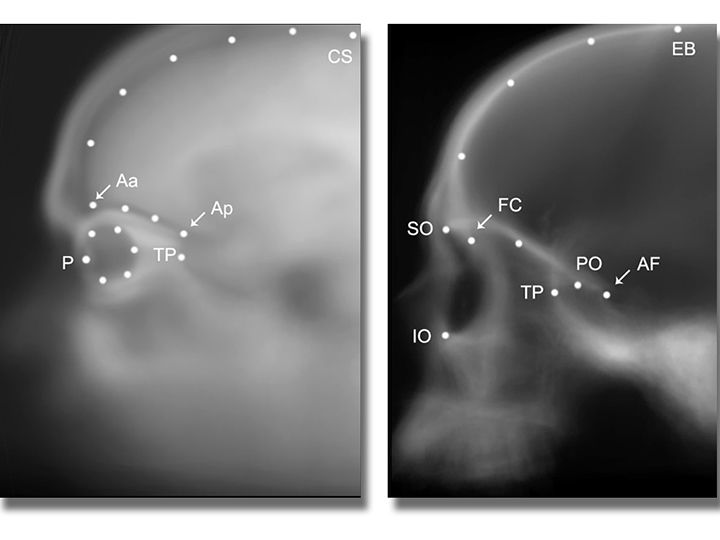 Investigan el conflicto entre el desarrollo de los ojos y de la corteza cerebral