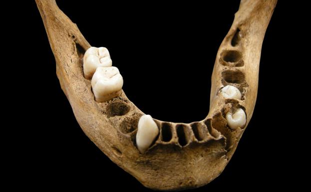 El MEH acoge este martes una charla sobre 'Dieta y patologías dentales en los muertos del convento de San Pablo'