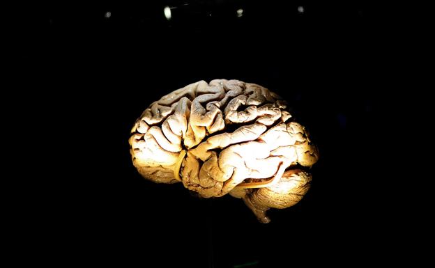 La música activa regiones del cerebro no afectadas por la enfermedad de Alzheimer