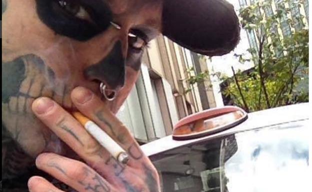 Fallece 'Zombie Boy'