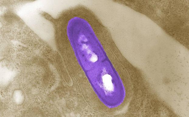 Sanidad aumenta a 13 los casos probables de listeriosis en Castilla y León, tres de ellos en Valladolid, y descarta el de Segovia