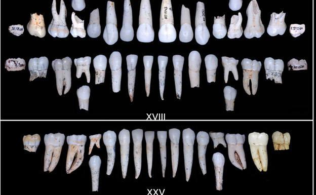 Los homininos de Atapuerca tenían un desarrollo dental más rápido que los humanos modernos
