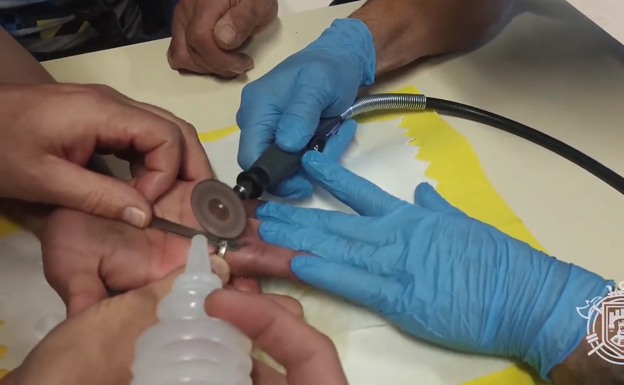 Un anillo atascado en un dedo obliga a intervenir a los Bomberos de Burgos